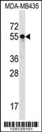 Solute Carrier Family 15 Member 3 antibody, MBS9207174, MyBioSource, Western Blot image 