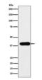 Adenosine Deaminase antibody, M00866-1, Boster Biological Technology, Western Blot image 