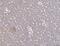 Cathepsin L antibody, A01589-3, Boster Biological Technology, Immunohistochemistry paraffin image 