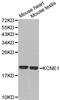 Potassium Voltage-Gated Channel Subfamily E Regulatory Subunit 1 antibody, PA5-75992, Invitrogen Antibodies, Western Blot image 