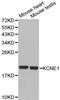 Potassium voltage-gated channel subfamily E member 1 antibody, PA5-75992, Invitrogen Antibodies, Western Blot image 