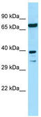 Eukaryotic Translation Initiation Factor 2B Subunit Beta antibody, TA338093, Origene, Western Blot image 