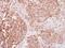 Insulin Receptor antibody, LS-C155319, Lifespan Biosciences, Immunohistochemistry paraffin image 