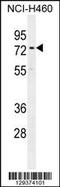 Coiled-Coil Domain Containing 63 antibody, 55-884, ProSci, Western Blot image 