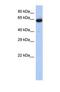 Leucine Rich Repeat Transmembrane Neuronal 1 antibody, NBP1-69330, Novus Biologicals, Western Blot image 