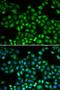 Proteasome Subunit Beta 1 antibody, LS-C331217, Lifespan Biosciences, Immunofluorescence image 