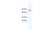 GATA Zinc Finger Domain Containing 2A antibody, A09194, Boster Biological Technology, Western Blot image 