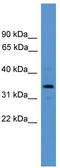 Arginase 2 antibody, TA335003, Origene, Western Blot image 