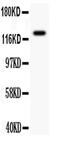 CD11b antibody, PA5-79535, Invitrogen Antibodies, Western Blot image 