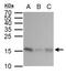 GABA Type A Receptor-Associated Protein antibody, GTX129710, GeneTex, Western Blot image 