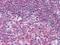 Protein Tyrosine Kinase 2 Beta antibody, MA5-15407, Invitrogen Antibodies, Immunohistochemistry frozen image 