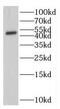 Interferon Induced Protein With Tetratricopeptide Repeats 5 antibody, FNab04139, FineTest, Western Blot image 
