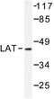 Large neutral amino acids transporter small subunit 1 antibody, LS-C176421, Lifespan Biosciences, Western Blot image 