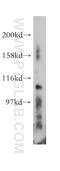 EPH Receptor A7 antibody, 13119-1-AP, Proteintech Group, Western Blot image 