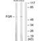 FGR Proto-Oncogene, Src Family Tyrosine Kinase antibody, PA5-49783, Invitrogen Antibodies, Western Blot image 