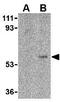 Fc Fragment Of IgM Receptor antibody, GTX38905, GeneTex, Western Blot image 