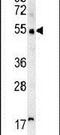 Scavenger Receptor Class A Member 5 antibody, PA5-23551, Invitrogen Antibodies, Western Blot image 