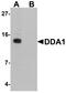 DET1 And DDB1 Associated 1 antibody, PA5-72703, Invitrogen Antibodies, Western Blot image 