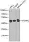 RISC-loading complex subunit TARBP2 antibody, A01680-1, Boster Biological Technology, Western Blot image 