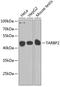 TARBP2 Subunit Of RISC Loading Complex antibody, A01680-1, Boster Biological Technology, Western Blot image 