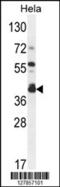 Delta 4-Desaturase, Sphingolipid 2 antibody, 55-272, ProSci, Western Blot image 