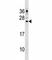 Cathelicidin Antimicrobial Peptide antibody, F45218-0.4ML, NSJ Bioreagents, Western Blot image 