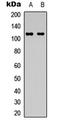 Protein Kinase D1 antibody, LS-C368479, Lifespan Biosciences, Western Blot image 