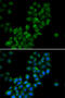 Calcium Activated Nucleotidase 1 antibody, abx004847, Abbexa, Western Blot image 