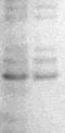 M-phase inducer phosphatase 3 antibody, TA354613, Origene, Western Blot image 