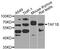 TATA-Box Binding Protein Associated Factor, RNA Polymerase I Subunit B antibody, STJ110470, St John
