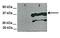 Tetraspanin 3 antibody, NBP1-62310, Novus Biologicals, Western Blot image 