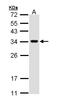 VAMP Associated Protein A antibody, LS-C109464, Lifespan Biosciences, Western Blot image 
