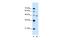 Solute Carrier Family 16 Member 12 antibody, PA5-42536, Invitrogen Antibodies, Western Blot image 