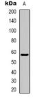 Zinc Finger Protein 596 antibody, LS-C368832, Lifespan Biosciences, Western Blot image 