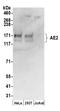 Anion exchange protein 2 antibody, A304-502A, Bethyl Labs, Western Blot image 