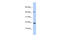 SREK1 Interacting Protein 1 antibody, 31-313, ProSci, Western Blot image 