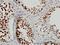 Cleavage Stimulation Factor Subunit 3 antibody, H00001479-M01, Novus Biologicals, Immunohistochemistry paraffin image 