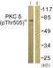 Protein Kinase C Delta antibody, PA5-38384, Invitrogen Antibodies, Western Blot image 