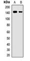 ATP Binding Cassette Subfamily B Member 11 antibody, LS-C668685, Lifespan Biosciences, Western Blot image 