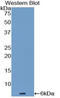 Endothelin 1 antibody, LS-B14598, Lifespan Biosciences, Western Blot image 