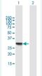 Retinol Dehydrogenase 16 antibody, H00008608-B01P-50ug, Novus Biologicals, Western Blot image 