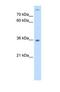 Lectin, Mannose Binding 2 antibody, NBP1-69475, Novus Biologicals, Western Blot image 