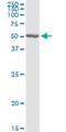 Chitinase Acidic antibody, H00027159-D01P, Novus Biologicals, Western Blot image 