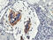 Calpain 9 antibody, M11197, Boster Biological Technology, Immunohistochemistry paraffin image 