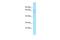 Extracellular Matrix Protein 2 antibody, A09257, Boster Biological Technology, Western Blot image 