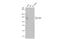 BAF Chromatin Remodeling Complex Subunit BCL11B antibody, GTX134767, GeneTex, Western Blot image 