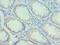 COP9 Signalosome Subunit 2 antibody, LS-C375507, Lifespan Biosciences, Immunohistochemistry frozen image 