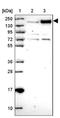 Serine/threonine-protein kinase SIK3 antibody, NBP2-47278, Novus Biologicals, Western Blot image 