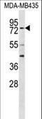 Regulatory Factor X3 antibody, LS-C162559, Lifespan Biosciences, Western Blot image 