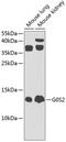 G0/G1 Switch 2 antibody, GTX66594, GeneTex, Western Blot image 